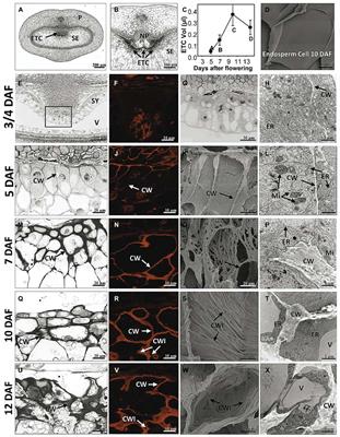 Development of endosperm transfer cells in barley